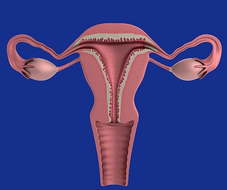 Endometriózis kezelése homeopátiával